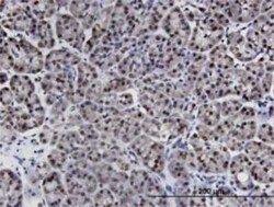 LIMD1 Antibody (2G5), Novus Biologicals 0.1 mg, Unconjugated:Antibodies,
