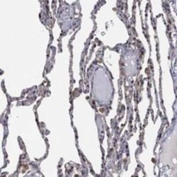LIMD1 Rabbit anti-Human, Polyclonal, Novus Biologicals 25 &mu;g; Unconjugated:Antibodies,