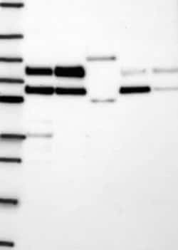 LIMD1 Rabbit anti-Human, Polyclonal, Novus Biologicals 25 &mu;g; Unconjugated:Antibodies,