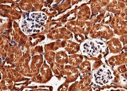LIMPII/SR-B2 Rabbit anti-Mouse, Clone: 52, Novus Biologicals:Antibodies:Primary