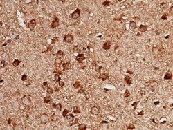 LIMPII/SR-B2 Rabbit anti-Mouse, Clone: 52, Novus Biologicals:Antibodies:Primary