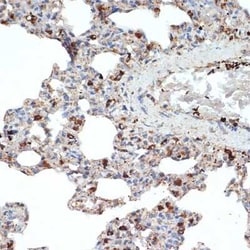 LIMPII/SR-B2 Rabbit anti-Human, Mouse, Rat, Clone: 7D2P5, Novus Biologicals:Antibodies:Primary