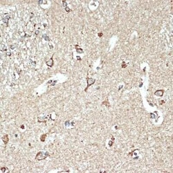 LIMPII/SR-B2 Rabbit anti-Human, Mouse, Rat, Clone: 7D2P5, Novus Biologicals:Antibodies:Primary