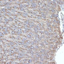LIMPII/SR-B2 Rabbit anti-Human, Mouse, Rat, Clone: 7D2P5, Novus Biologicals:Antibodies:Primary