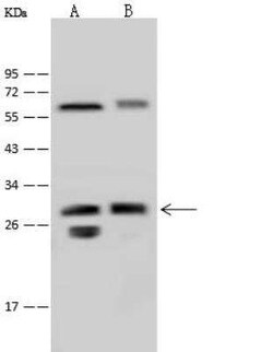 LIN7 Antibody, Novus Biologicals 100 &mu;g; Unconjugated:Antibodies, Polyclonal