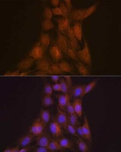 LIS1 Rabbit anti-Human, Mouse, Rat, Clone: 9O6X3, Novus Biologicals 20