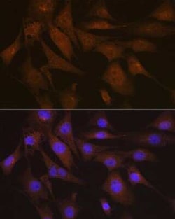 LIS1 Rabbit anti-Human, Mouse, Rat, Clone: 9O6X3, Novus Biologicals 20