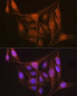 LIS1 Rabbit anti-Human, Mouse, Rat, Clone: 9O6X3, Novus Biologicals 20