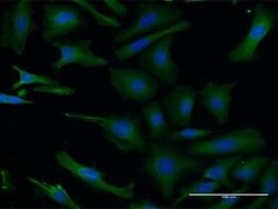 LIS1 Antibody (5A5), Novus Biologicals 0.1 mg | Buy Online | Novus Biologicals | Fisher Scientific