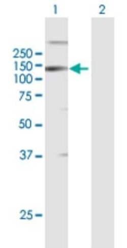 LLGL2 Antibody, Novus Biologicals 50 &mu;g | Buy Online | Novus Biologicals | Fisher Scientific