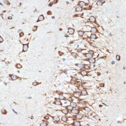 LMAN1 Rabbit anti-Human, Mouse, Rat, Clone: 3A1X6, Novus Biologicals 20