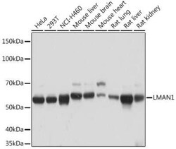 LMAN1 Rabbit anti-Human, Mouse, Rat, Clone: 3A1X6, Novus Biologicals 20