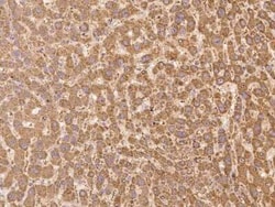 LMBRD2 Antibody, Novus Biologicals 50 &mu;g; Unconjugated:Antibodies, Polyclonal
