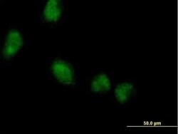 LMCD1 Antibody, Novus Biologicals 0.05 mg | Buy Online | Novus Biologicals | Fisher Scientific
