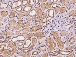 LMCD1 Antibody, Novus Biologicals 100 &mu;g, Unconjugated:Antibodies, Polyclonal