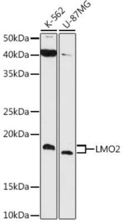 LMO2 Rabbit anti-Human, Clone: 9O5X9, Novus Biologicals 100 &mu;g | Buy Online | Novus Biologicals | Fisher Scientific
