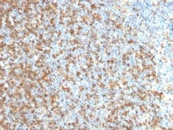 LMO2 Antibody (LMO2/1971) - Azide and BSA Free, Novus Biologicals 100 &mu;g | Buy Online | Novus Biologicals | Fisher Scientific