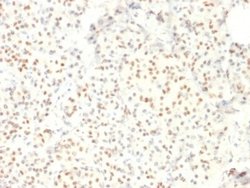 LMO2 Antibody (LMO2/1971) - Azide and BSA Free, Novus Biologicals 100 &mu;g | Buy Online | Novus Biologicals | Fisher Scientific
