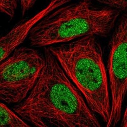 LMO4 Antibody, Novus Biologicals:Antibodies:Primary Antibodies