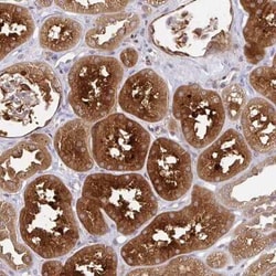 LMO4 Antibody, Novus Biologicals:Antibodies:Primary Antibodies