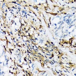 LMP2/PSMB9 Rabbit anti-Human, Mouse, Rat, Clone: 7Q2G4, Novus Biologicals:Antibodies:Primary