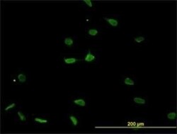 LMP7/PSMB8 Antibody (1B3), Novus Biologicals 0.1 mg | Buy Online | Novus Biologicals | Fisher Scientific