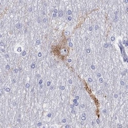 LMTK3 Antibody, Novus Biologicals:Antibodies:Primary Antibodies