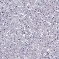 LMTK3 Antibody, Novus Biologicals:Antibodies:Primary Antibodies