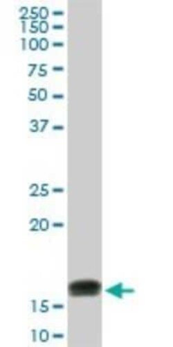 LMW-PTP/ACP1 Antibody (4B10), Novus Biologicals 0.1 mg | Buy Online | Novus Biologicals | Fisher Scientific