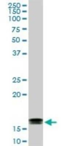 LMW-PTP/ACP1 Antibody (4B10), Novus Biologicals 0.1 mg | Buy Online | Novus Biologicals | Fisher Scientific