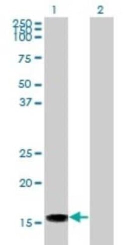LMW-PTP/ACP1 Antibody (4B10), Novus Biologicals 0.1 mg | Buy Online | Novus Biologicals | Fisher Scientific