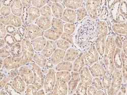 LMW-PTP/ACP1 Antibody, Novus Biologicals 50 &mu;g; Unconjugated:Antibodies,