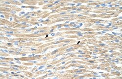 LMX1A Rabbit anti-Human, Polyclonal, Novus Biologicals 0.1ml; Unconjugated:Antibodies,