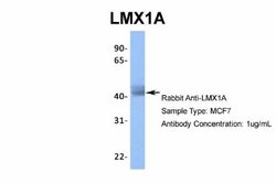 LMX1A Rabbit anti-Human, Polyclonal, Novus Biologicals 0.1ml; Unconjugated:Antibodies,