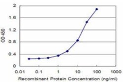 LMX1b Antibody (1D12), Novus Biologicals 0.1 mg, Unconjugated:Anticuerpos