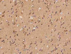 LMX1b Antibody, Novus Biologicals 100 &mu;g; Unconjugated:Antibodies, Polyclonal