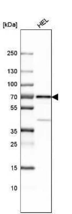 LNK/SH2B3 Antibody, Novus Biologicals 0.1 mL; Unconjugated:Antikörper