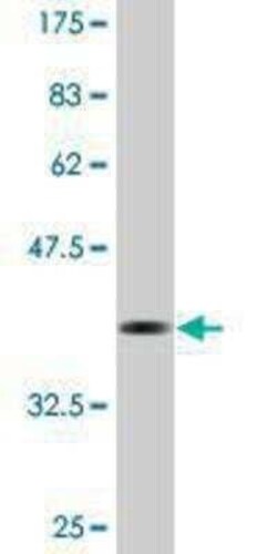 LONP1 Antibody (3B2), Novus Biologicals 0.1 mg | Buy Online | Novus Biologicals | Fisher Scientific
