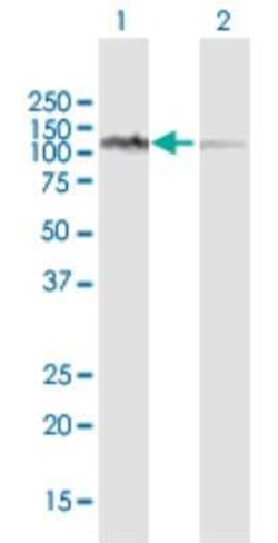 Novus Biologicals LONP1 Antibody, Novus Biologicals 0.1 mg | Buy Online | Novus Biologicals&trade; | Fisher Scientific