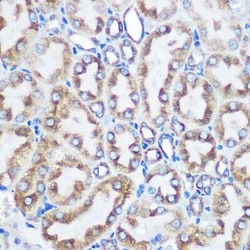 LOX Rabbit anti-Human, Mouse, Rat, Clone: 9K10Z3, Novus Biologicals 100