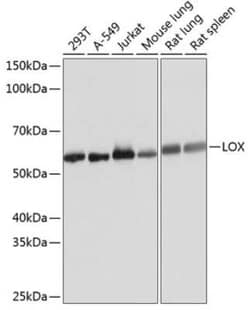 LOX Rabbit anti-Human, Mouse, Rat, Clone: 9K10Z3, Novus Biologicals 100