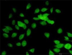 LOXL1 Antibody, Novus Biologicals 0.1 mg | Buy Online | Novus Biologicals | Fisher Scientific