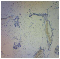 LOXL1 Antibody, Novus Biologicals 100 &mu;g | Buy Online | Novus Biologicals | Fisher Scientific