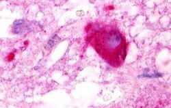 LPAR5/LPA5/GPR92 Antibody - BSA Free, Novus Biologicals 0.05 mL, Unconjugated:Anticuerpos