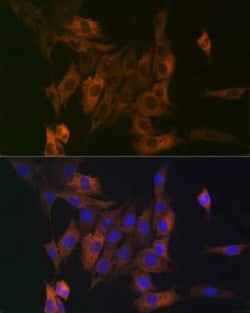 LPP Rabbit anti-Human, Mouse, Rat, Clone: 8M2R8, Novus Biologicals:Antibodies:Primary
