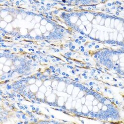 LPP Rabbit anti-Human, Mouse, Rat, Clone: 8M2R8, Novus Biologicals:Antibodies:Primary