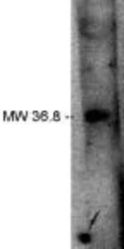 LPPR2 Rabbit anti-Human, Polyclonal, Novus Biologicals:Antibodies:Primary