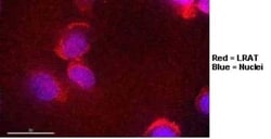 LRAT Antibody (M34-P1F10) - BSA Free, Novus Biologicals 0.025 mL, Unconjugated:Antibodies,