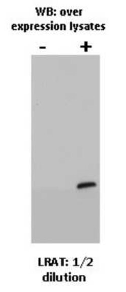 LRAT Antibody (M34-P1F10) - BSA Free, Novus Biologicals 0.025 mL, Unconjugated:Antibodies,