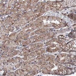 LRCH4 Antibody, Novus Biologicals 25 &mu;L; Unconjugated:Antibodies, Polyclonal